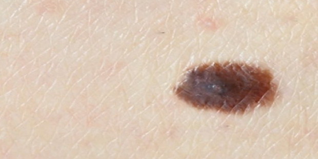 Besplatni dermatološki pregledi